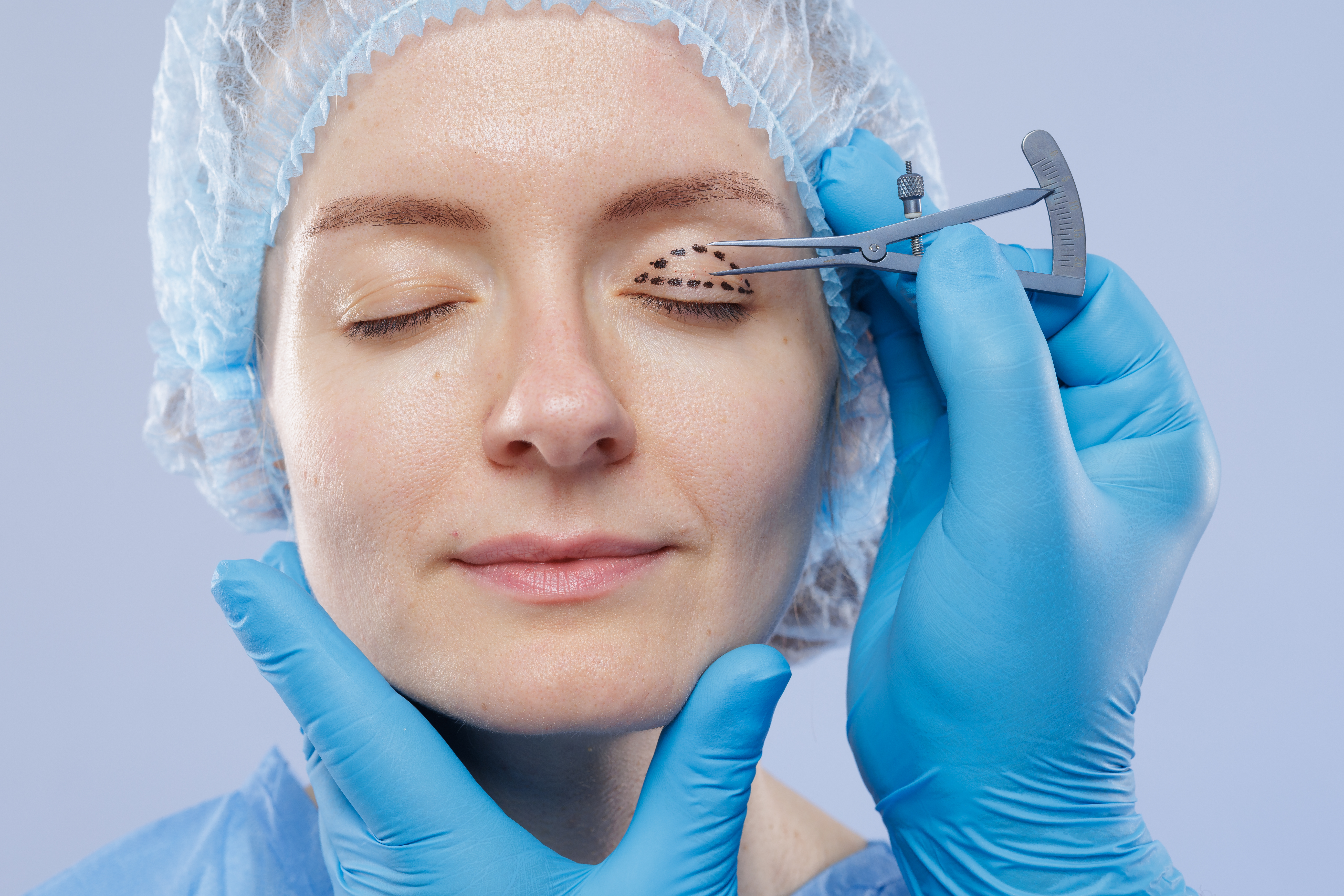 Atención de oculoplástica y vías lagrimales en Grupo Prover